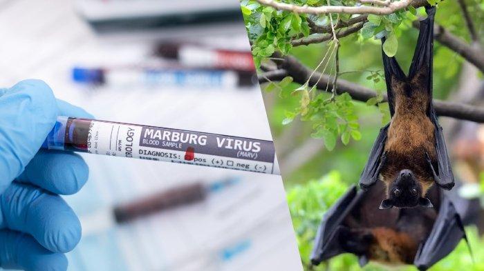 rwanda-laporkan-26-kasus-virus-marburg-enam-di-antaranya-berujung-kematian_f71d512.jpg