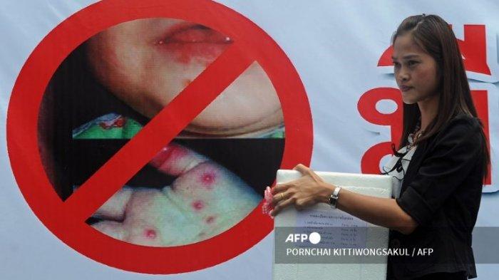 kenali-tanda-saat-anak-kena-penyakit-tangan-kaki-dan-mulut-ini-cara-menanganinya_f4e64eb.jpg