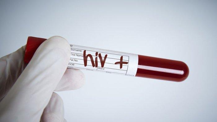 hiv-masih-dianggap-aib-dokter-hindari-penyakitnya-bukan-orangnya-_f7f540f.jpg